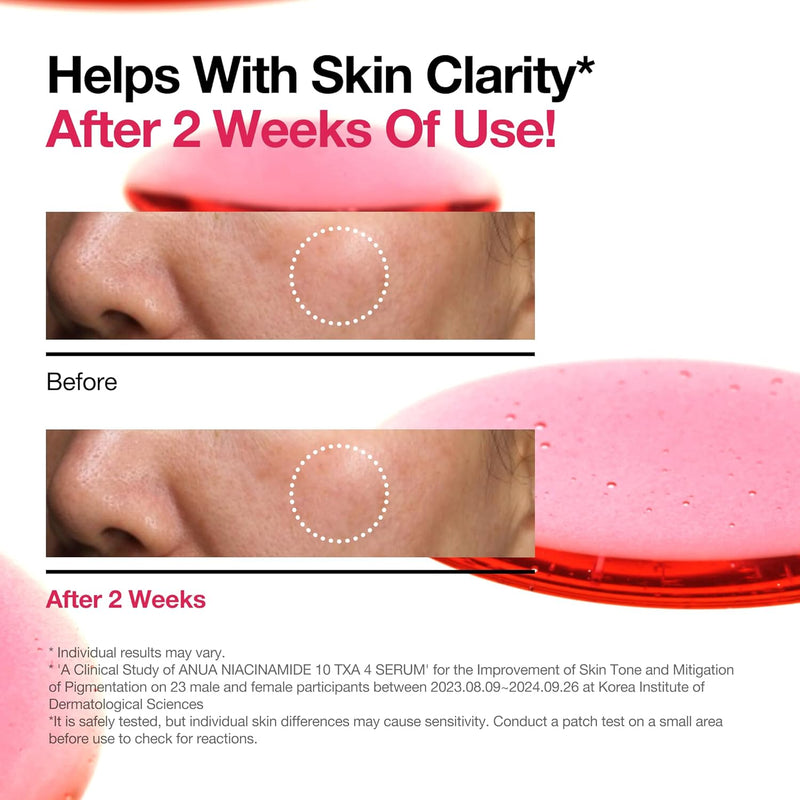ANUA Niacinamide 10 + TXA 4 Serum