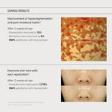 SOME BY MI Yuja Niacin Anti Blemish Cream